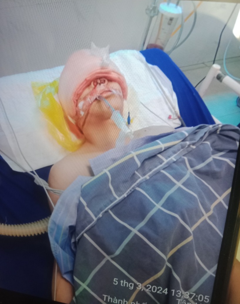 Xót xa hoàn cảnh nam sinh chấn thương nặng trong vụ tai nạn xe khách ở Tuyên Quang- Ảnh 1.