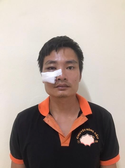 Bắt giữ đối tượng tông gãy chân CSGT Bắc Giang khi bị kiểm tra nồng độ cồn- Ảnh 1. Bắt giữ đối tượng tông gãy chân CSGT Bắc Giang khi bị kiểm tra nồng độ cồn- Ảnh 1.