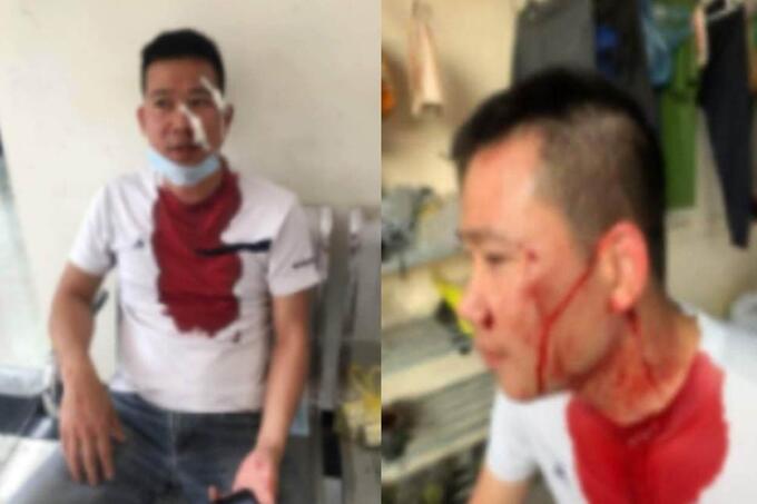 Hình ảnh anh Bằng bị thương tích, mặt mũi be bét máu