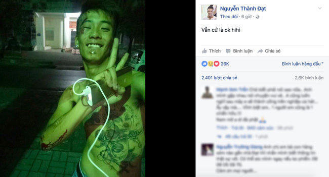 2 %22Bản sao Tuấn Hưng%22 đột ngột qua đơ