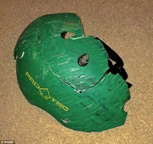 13 Những hình ảnh lý giải vì sao phải độ