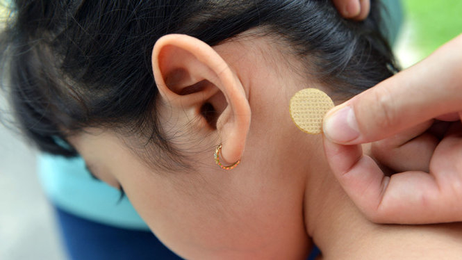 Miếng dán chống say xe gây loạn thần