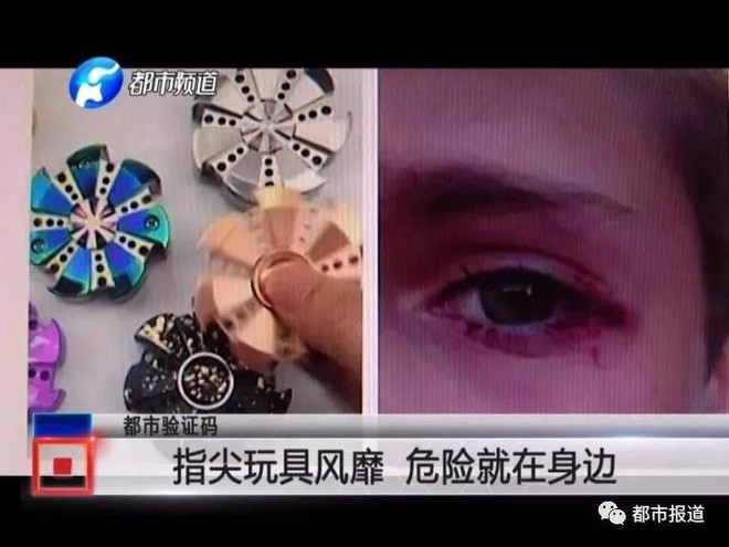 Hiểm họa không ngờ từ món đồ chơi đang