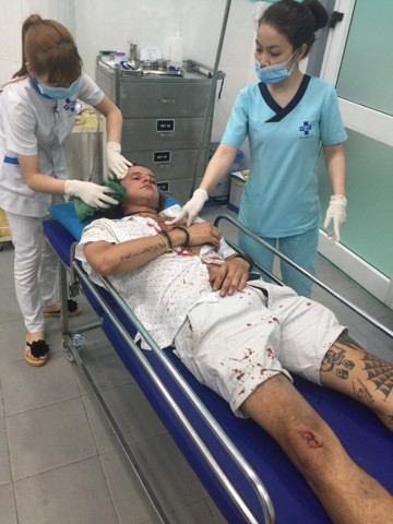 Điều tra vụ du khách Úc bị nhóm xe ôm Hội An đánh 