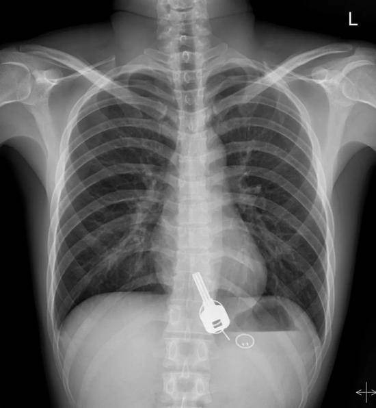 photo-1-15601445919011620599237