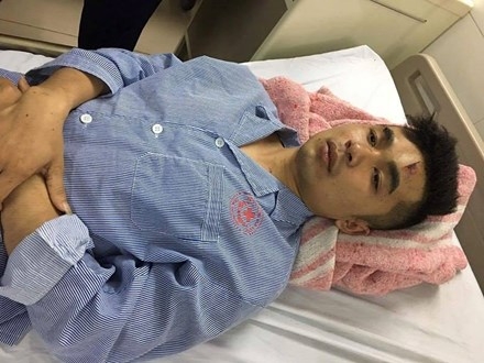 16901582_1323370924383554_1657613718_n_ABPY