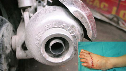 gan-op-inox3-1535376316