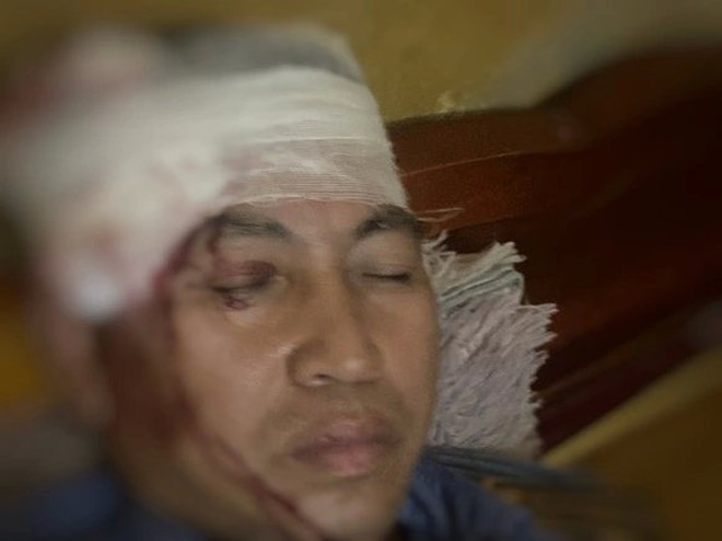 VNR đề nghị Công an Yên Bái điều tra vụ ném đá lên tàu khiến một phụ lái nhập viện- Ảnh 2.