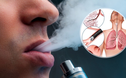 Thuốc lá điện tử ảnh hưởng như thế nào đến phổi?