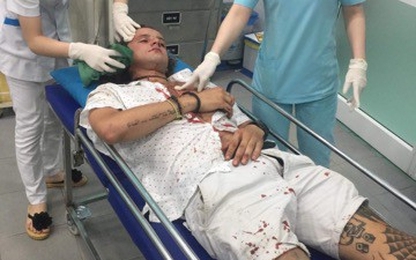 Điều tra vụ du khách Úc bị nhóm xe ôm Hội An đánh nhập viện