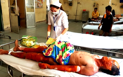 Cháy tàu chở xăng dầu ở miền Tây, hai người bỏng nặng