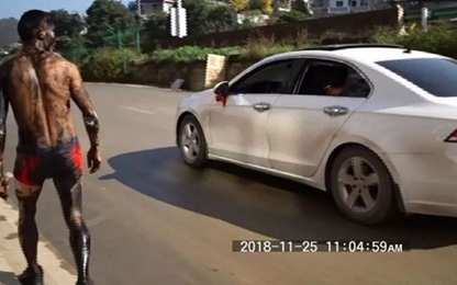 Bị TNGT trong ngày cưới, chú rể kiện bạn bè của mình