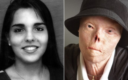 Mỹ: Biểu tượng của sự nguy hiểm khi lái xe say xỉn đã qua đời