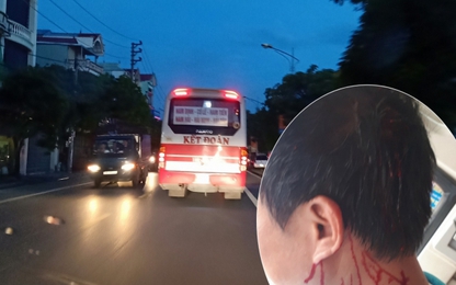 Phụ xe khách bị đánh toác đầu, gục ngã giữa đất Thủ đô