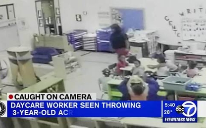 Cô giáo Mỹ ném bé 3 tuổi vào tủ gây rách trán